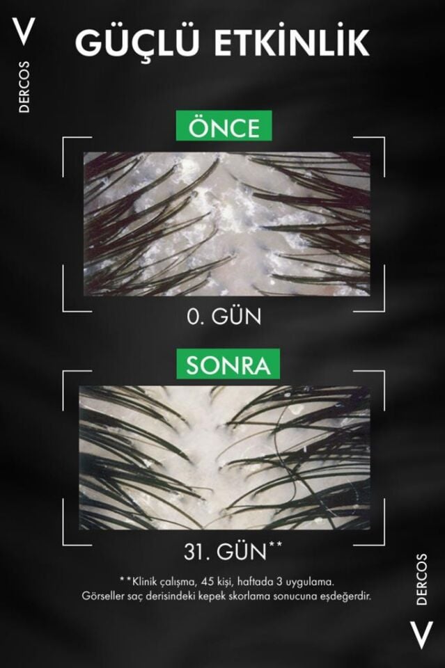 Vichy Dercos Anti Dandruff Kuru Saçlar Kepek Karşıtı 390 ml Şampuan