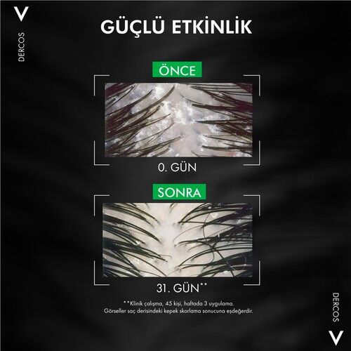 Vichy Dercos Anti Dandruff Kepek Karşıtı Şampuan 500 ml Normal ve Yağlı Saçlar