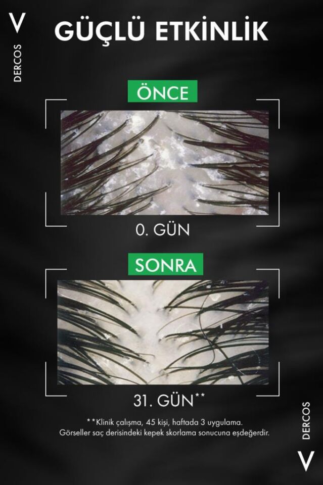 Vichy Dercos Anti Dandruff Kuru Saçlar Kepek Karşıtı 390 ml Şampuan