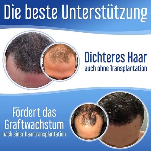 Xpecia Erkek 60 Tablet